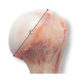 Osteoarticular humeral head